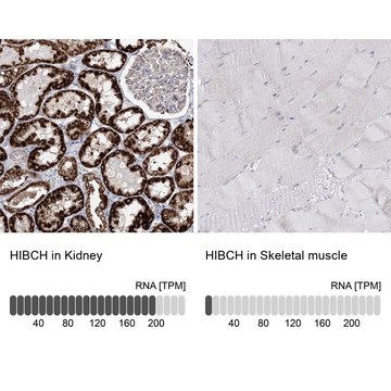 Anti-HIBCH antibody produced in rabbit Prestige Antibodies&#174; Powered by Atlas Antibodies, affinity isolated antibody, buffered aqueous glycerol solution