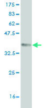 Monoclonal Anti-QPCT antibody produced in mouse clone 4E11, purified immunoglobulin, buffered aqueous solution