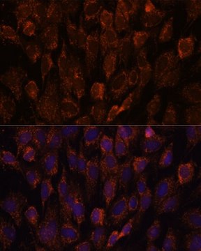 Anti-NSDHL antibody produced in rabbit