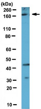 Anti-Set1A Antibody serum, from rabbit