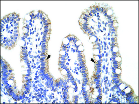 Anti-EXOSC10 antibody produced in rabbit IgG fraction of antiserum