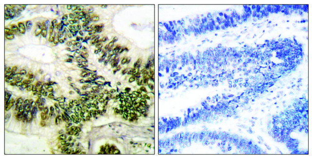 Anti-Cyclin E1 antibody produced in rabbit affinity isolated antibody