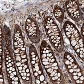 Anti-WDR73 antibody produced in rabbit Prestige Antibodies® Powered by Atlas Antibodies, affinity isolated antibody, buffered aqueous glycerol solution