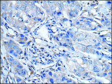 Anti-LTBP4 affinity isolated antibody