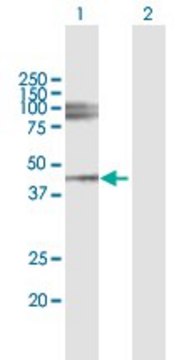 Anti-LUM antibody produced in mouse purified immunoglobulin, buffered aqueous solution