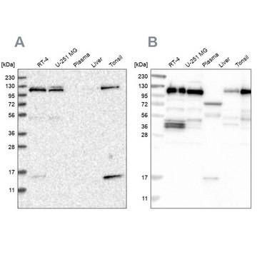 Anti-RABEP1 antibody produced in rabbit Prestige Antibodies&#174; Powered by Atlas Antibodies, affinity isolated antibody, buffered aqueous glycerol solution, Ab3