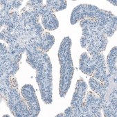 Anti-FAM161A antibody produced in rabbit Prestige Antibodies® Powered by Atlas Antibodies, affinity isolated antibody, buffered aqueous glycerol solution
