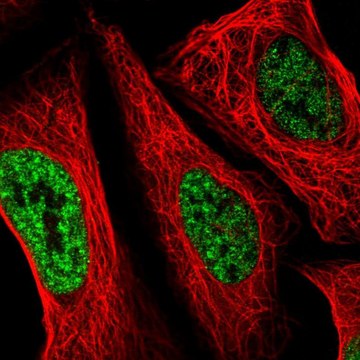 Anti-SETD4 antibody produced in rabbit Prestige Antibodies&#174; Powered by Atlas Antibodies, affinity isolated antibody