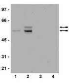 Anti-phospho-PPARγ (Ser82) Antibody, clone AW504, rabbit monoclonal clone AW504, from rabbit