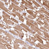 Anti-INPP4B antibody produced in rabbit Prestige Antibodies® Powered by Atlas Antibodies, affinity isolated antibody, buffered aqueous glycerol solution