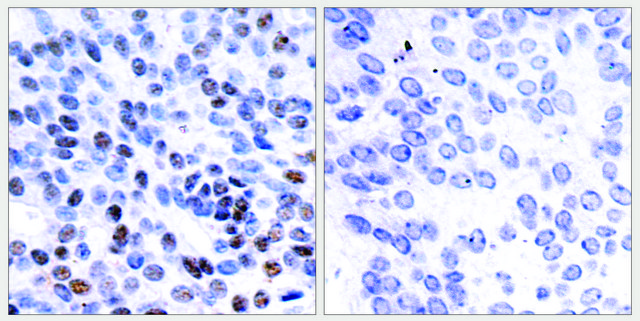 Anti-JUNB antibody produced in rabbit affinity isolated antibody