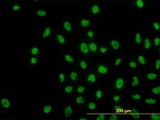 Monoclonal Anti-ARID1B antibody produced in mouse clone 2D2, purified immunoglobulin, buffered aqueous solution