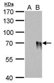 Monoclonal Anti-Influenza A virus H1N1 HA (Hemagglutinin) antibody produced in mouse clone GT223, affinity isolated antibody