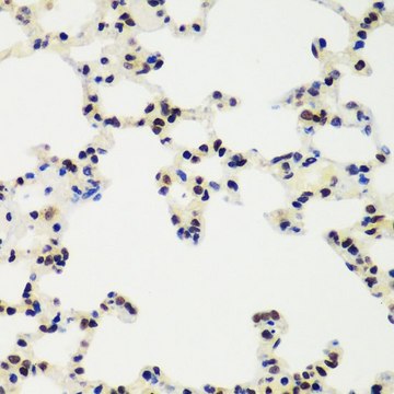 Anti-RING1B/RNF2 antibody produced in rabbit