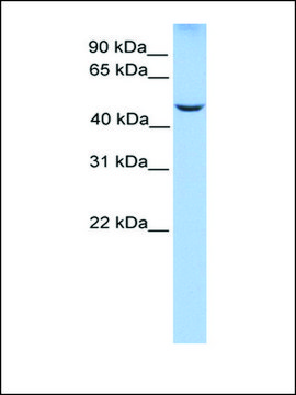 Anti-PHF17 (AB2) antibody produced in rabbit affinity isolated antibody