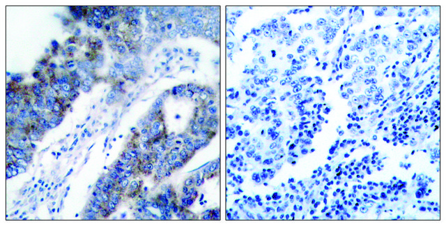 Anti-ASK1 antibody produced in rabbit affinity isolated antibody