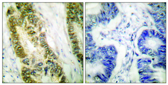 Anti-SP1 antibody produced in rabbit affinity isolated antibody