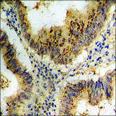 Anti-phospho-CDC37 (pSer13) antibody produced in rabbit affinity isolated antibody