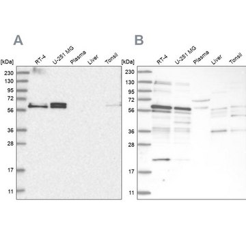 Anti-TSPYL1 antibody produced in rabbit Prestige Antibodies&#174; Powered by Atlas Antibodies, affinity isolated antibody, buffered aqueous glycerol solution