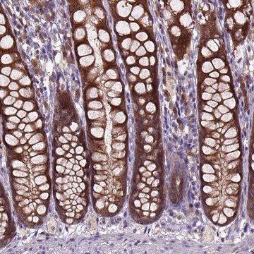 Anti-ARL1 antibody produced in rabbit Prestige Antibodies&#174; Powered by Atlas Antibodies, affinity isolated antibody, buffered aqueous glycerol solution