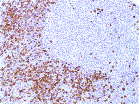 Anti-CD8 antibody, Rabbit monoclonal recombinant, expressed in proprietary host, clone SP16, tissue culture supernatant