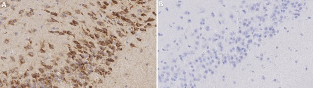 Anti-Sortilin Antibody, clone 2F18 ZooMAb&#174; Rabbit Monoclonal recombinant, expressed in HEK 293 cells