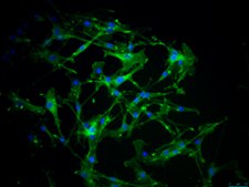YUMM 1.1 Mouse Melanoma Cell Line