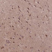 Anti-SEC14L2 antibody produced in rabbit Prestige Antibodies® Powered by Atlas Antibodies, affinity isolated antibody, buffered aqueous glycerol solution