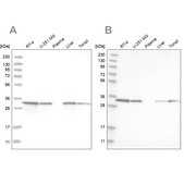 Anti-GLOD4 antibody produced in rabbit Prestige Antibodies® Powered by Atlas Antibodies, affinity isolated antibody, buffered aqueous glycerol solution, Ab2
