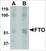 Anti-FTO antibody produced in rabbit affinity isolated antibody, buffered aqueous solution