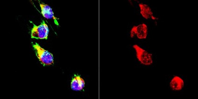 Anti-La-Related Protein 1 from rabbit, purified by affinity chromatography