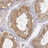 Anti-NMT2 antibody produced in rabbit Prestige Antibodies&#174; Powered by Atlas Antibodies, affinity isolated antibody, buffered aqueous glycerol solution