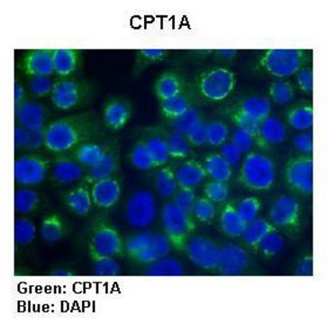 Anti-CPT1A antibody produced in rabbit affinity isolated antibody