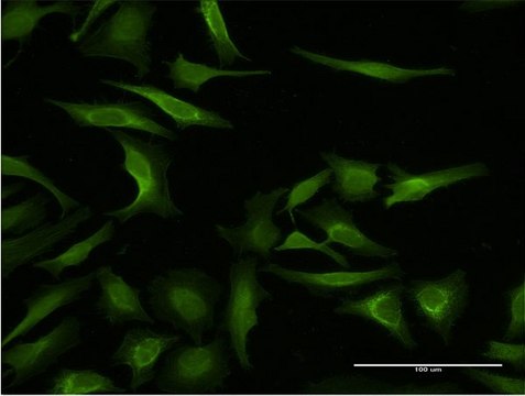 Monoclonal Anti-MAGEA3 antibody produced in mouse clone 4D9, purified immunoglobulin, buffered aqueous solution