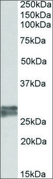 Anti-TNNI3 antibody produced in goat affinity isolated antibody, buffered aqueous solution