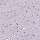 Anti-NLRP11 antibody produced in rabbit Prestige Antibodies® Powered by Atlas Antibodies, affinity isolated antibody, buffered aqueous glycerol solution