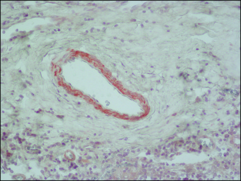 Anti-Calponin antibody, Mouse monoclonal clone hCP, purified from hybridoma cell culture