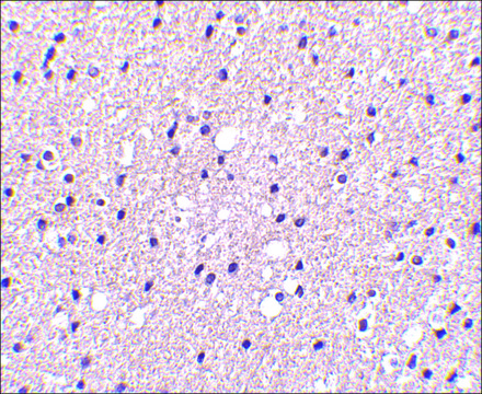 Anti-Presenilin1 antibody produced in rabbit affinity isolated antibody, buffered aqueous solution