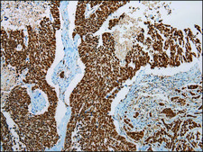 Anti-LSAMP affinity isolated antibody