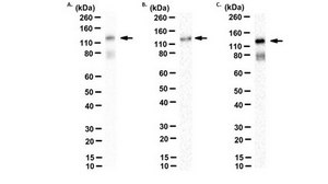 Anti-Amyloid Beta A4 protein Antibody, clone 2D8 clone 2D8, from rat