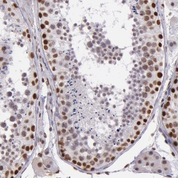 Anti-NBN antibody produced in rabbit Prestige Antibodies&#174; Powered by Atlas Antibodies, affinity isolated antibody, buffered aqueous glycerol solution