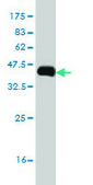 Monoclonal Anti-IL31RA antibody produced in mouse clone 3A10, purified immunoglobulin, buffered aqueous solution
