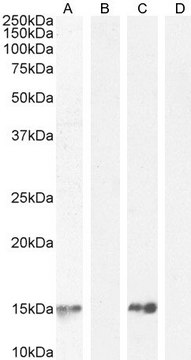 Anti-Parvalbumin antibody produced in goat affinity isolated antibody, buffered aqueous solution