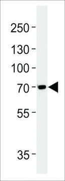 ANTI-TAU (MAPT) (S720) antibody produced in rabbit affinity isolated antibody, buffered aqueous solution