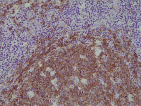 Anti-CD19 antibody, Rabbit monoclonal recombinant, expressed in HEK 293 cells, clone RM332, purified immunoglobulin