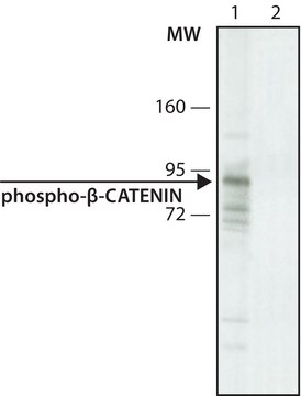 Anti-phospho-&#946;-Catenin (pSer33/pSer37) antibody, Mouse monoclonal clone BC-22, purified from hybridoma cell culture