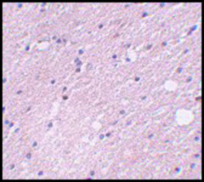 Anti-FRMPD4 antibody produced in rabbit affinity isolated antibody, buffered aqueous solution