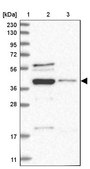 Anti-RBMX2 antibody produced in rabbit Prestige Antibodies® Powered by Atlas Antibodies, affinity isolated antibody, buffered aqueous glycerol solution