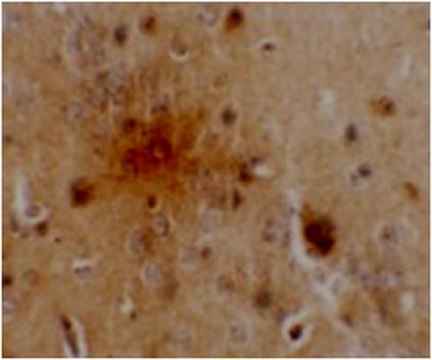 Anti-SEC62 Antibody from rabbit, purified by affinity chromatography