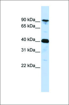 Anti-CARS antibody produced in rabbit affinity isolated antibody